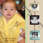 karsen's 1st surgery (thines)