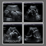 ultrasound with twins (Parisgirl55@hotmail.com)